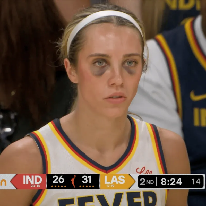 海洋之神·hy590官网-NBA Memes晒女球员眼眶乌黑图片:发生了什么???
